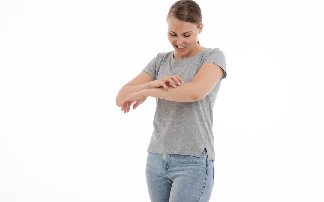 Femme en tee-shirt se grattant le bras